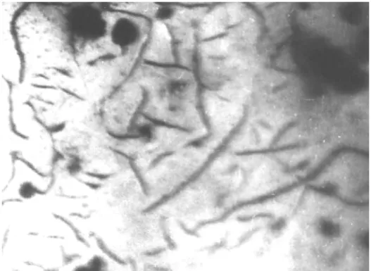 Figure 7. Microstructure of C.I. cast by sample A (x100). 