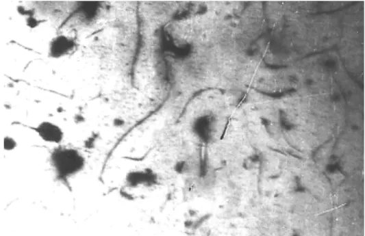Figure 11. Microstructure of C.I. cast by sample A4 (x100). 