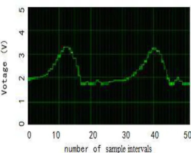 Figure 6. Knee joint angle curve of IPL measured at prosthetic leg side. 