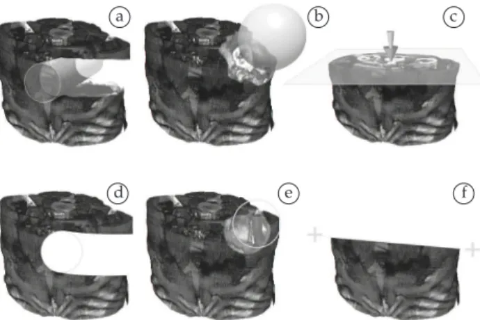 Figure  2. a) Part of the jaw (left side) is missing due to trauma; and  b) Voxels filled with material to model a prosthesis.