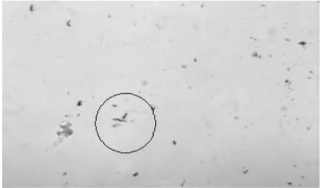 FIG. 5: Gram-stain micrography of E. coli irradiated with a dose of 0 . 4Gy with proton beams (magnification of 1000x).