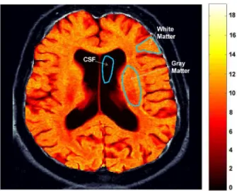FIG. 6: Map of relaxation rate R2 of an axial slice from a human brain superposed on T2-weighted image