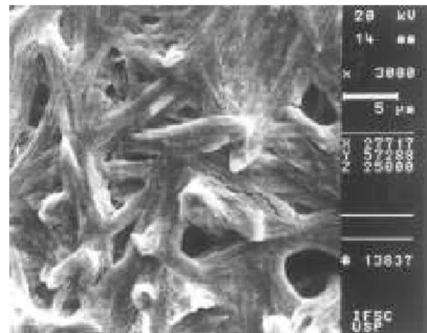 Figure 2. X-ray diffractogram of the Ti/PbO 2  electrode produced by the thermal-galvanostatic method.