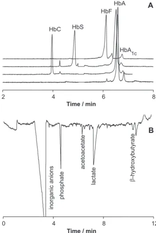 Figure 1. Clinical Applications of Capillary Electrophoresis: analy- analy-sis of hemoglobins and its variants in hemolysate (A) and ketoacids in human serum (B)