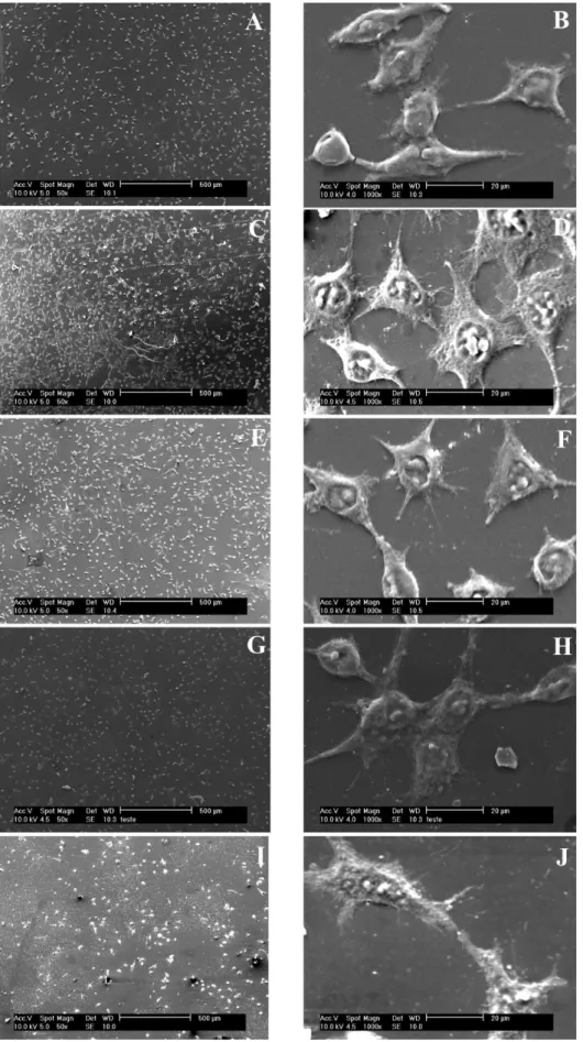 Figure 1. SEM pictures of L929 ibroblasts on the surface of pure PS ilm (A and B), PS/PMMA blend ilm (1:1) (C and D), pure PMMA ilm (E and F),  PS-b-PMMA copolymer ilm (G and H) and control (I and J) after 24 hours of cell culture