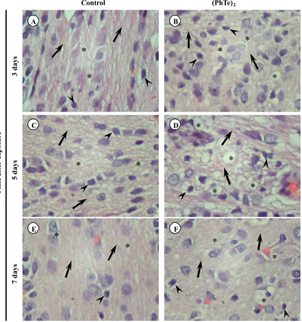 Figure 8. Photomicrography of the cerebellar white matter of: A,C,E) control group shows normal axons (arrow), myelin sheath (*) and oligodendrocytes  (arrowhead)