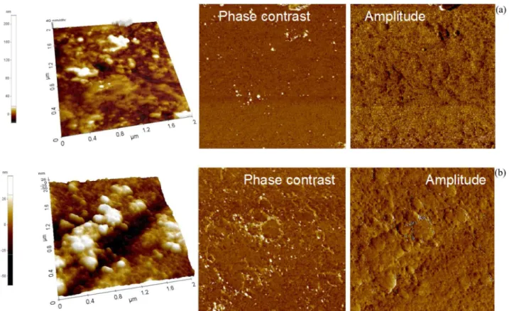 Figure 4 AFM micrographs in topographical, phase contrast and amplitude modes of coated Ti-20Nb-10Zr-5Ta alloy surface immersed for 300 h in  Ringer’s solutions of: (a) pH 7.58 and (b) pH 8.91.