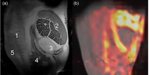 Figure 1 shows the results of an MR imaging study  of an oyster. Figure 1a shows one slice out of a 12-slice 