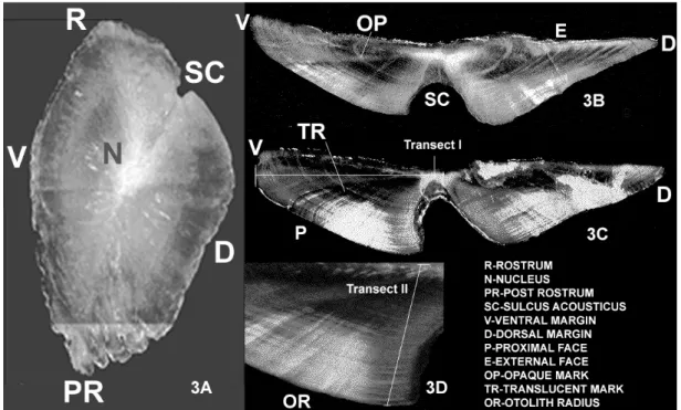 Fig. 3.  Whole and Sectioned otoliths of Lutjanus jocu under reflected light in a black background showing the translucent  and opaque bands and the different otolith regions considered for measurements