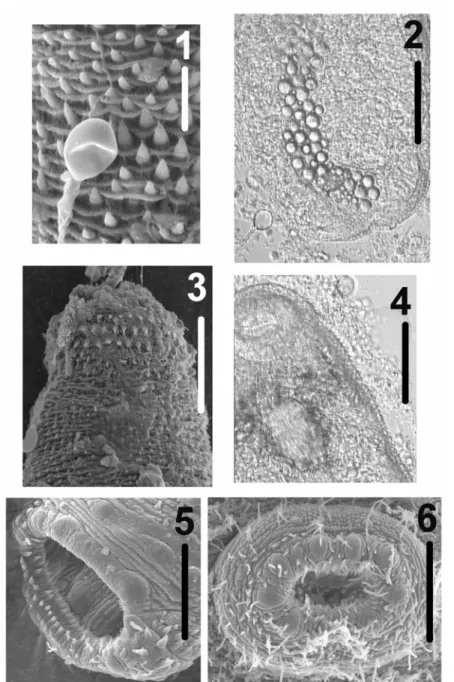 Fig. 1. Scanning electron micrograph of the surface of the metacercaria of Opechona sp.,  showing a nematocyst attached to the spinous tegument