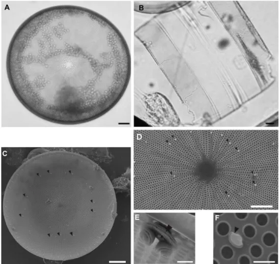 Fig. 2. Light microscopy images (Figs. A and B) and Scanning electron microscopy  (Figs.C- F) of Coscinodiscus  wailesii