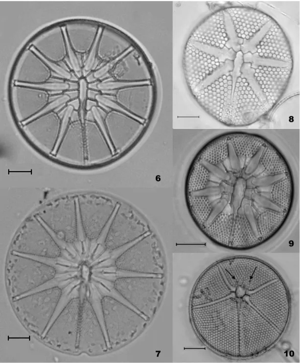 Figs 6 – 9. Asteromphalus spp. LM images. Fig. 6. A. elegans; Fig. 7. A. flabellatus; Fig