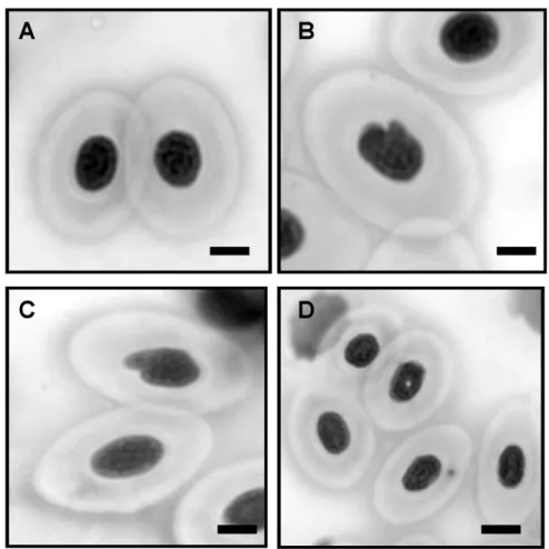 Fig.  2.  Cathorops  spixii  erythrocytes.(A)  Normal;  (B)  Notched.  Note  a  deep  notch  in  a  nucleus;  (C)  Lobed