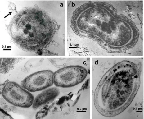 Fig.  4.  Picoprokaryotes  cells,  TEM.  Fig.  4a.Prochlorococcuscell  showing  some  ultrastructural  characteristics  and  one  virus  attached  (arrow)  (0.64  µm  diameter)