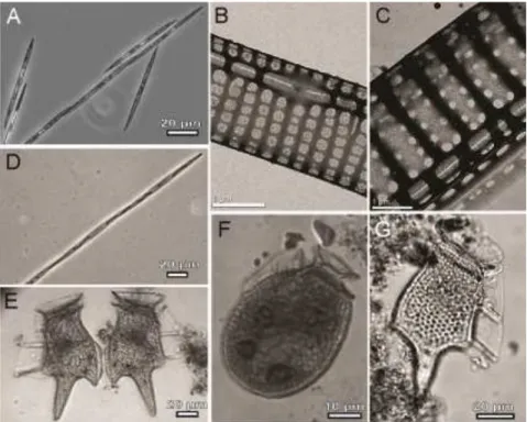 Fig. 6. Potentially toxic microalgal species identified in samples from Guaratuba Bay, PR by light  microscopy  (A,  D-G)  and  transmission  electron  microscopy  (B,  C):  (A,  B)  Pseudo-nitzschia  calliantha , (C, D)  P