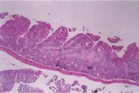 Figure 2 - Representative hematoxylin and eosin-stained section of jejunum of animal from malnutrition and regular chow diet group