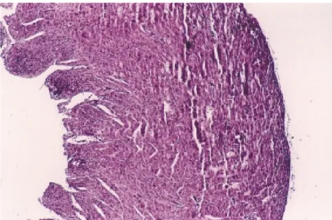 Figure 7 - Microscopic field of ventricular wall from a heart of CDH fetus. Note that the wall is thinner in comparison to a control fetus, showed in Fig