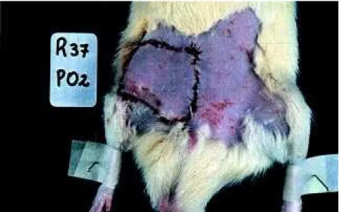 Table 1 - Analysis of microsurgic cutaneous transplantations survival in the individuals within 30 days