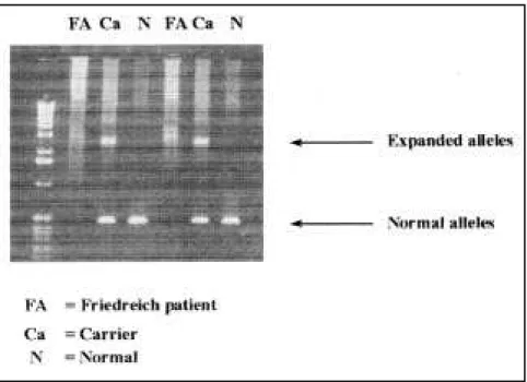 Figure 1 - Gel images of GAA expansion of Friedreich’s ataxia patients, heterozygotes, and normal controls.