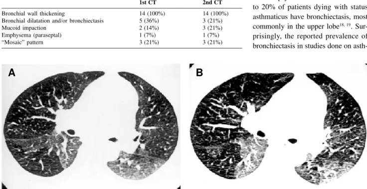 Table 2 - HRCT findings in the 14 asthmatic patients at the first and second evaluation.