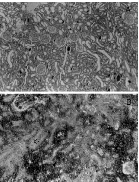 Figure 2 -  Histologic kidney sections obtained from groups I and III  (HE).