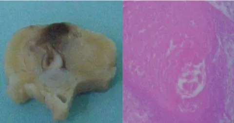 Figure 4 – Removal of the vertebral column from the C5 to L5 level.