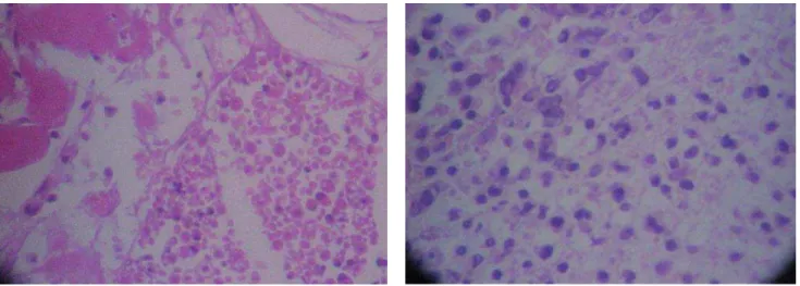 Figure 6 - A – A Microscopic section showing groups of fetal cells at the site of the injury