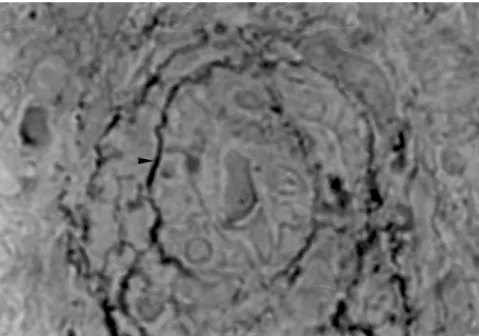 Figure 1 - Micrograph of a pulmonary artery with ED > 100 µm showing an internal elastic laminae (arrowhead) with some other elastic laminae in the medial wall (Weigert-hematoxylin, x400).