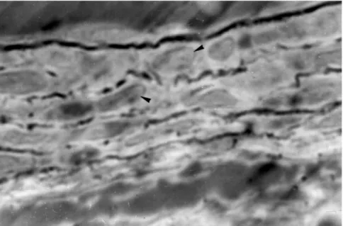 Table 2 - Values of morphometric data of arteries with external diameter £ 100 µm.