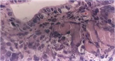 Figure 1 - Ruptured pseudocystis of acinar and pancreatic ductal cells releasing parasites to the extracellular medium