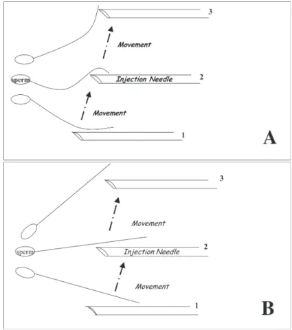 Figure 1 - A) Sperm tail flexibility test (STFT)-positive result; B) STFT-negative result.