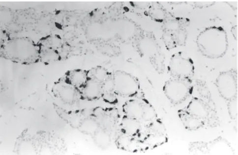 Figure 1 - Histological section of thyroid showing an increase in C cell number in pinealectomized rats (stained for calcitonin, 200x).