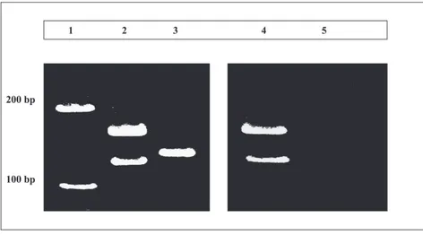 Figure 1 - Clonal IgH (CDRIII) gene rearrangement detected by FR3-JH polymerase chain reaction (PCR)