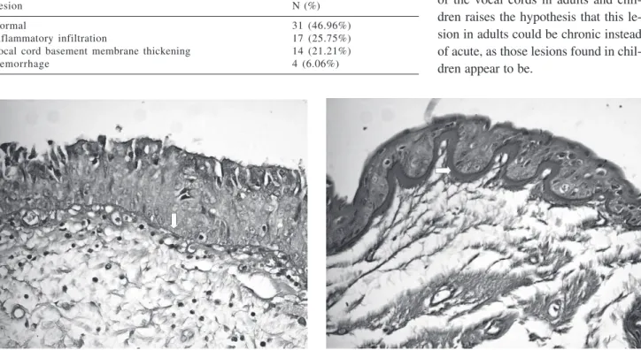 Table 2 - Description of lesions of vocal cords from autopsied subjects.