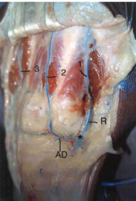 Figure 1 - The most common pattern of ramification of the radial artery at the level of anatomic snuffbox.