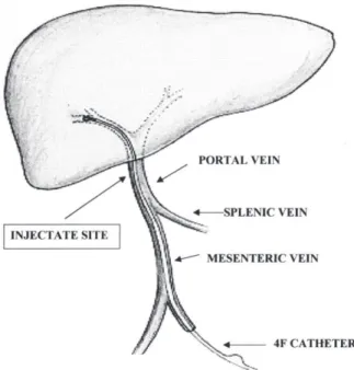 Figure 1 - Illustration showing the correct positioning of the 4F thermodilution catheter inside the portal vein.