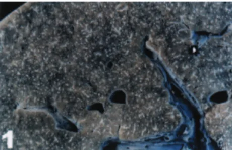 Figure 2 - Case 2: Gross aspect of spleen with whitish dots with reflected light.