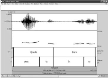 Table 1 shows that the overall grade of dysphonia (G)  (100%), the pitch (100%), and the vocal instability (I) (56.25%)  were the vocal parameters that most improved after  speech--language therapy, demonstrating that there was an overall  improvement in v