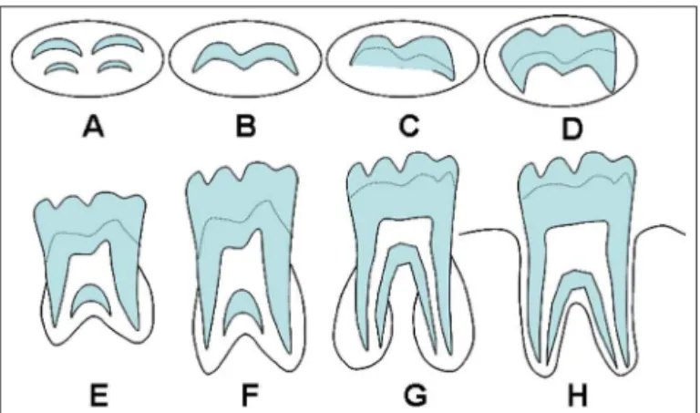 Fig. 1. Classification of the degree of mineralization of molar  teeth according to Demirjian et al