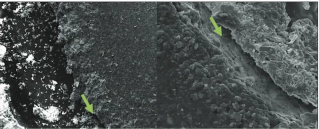 Fig. 2.  Interface dentin-sealer AH Plus. Left: 150x; Right: 1000x (SEM).