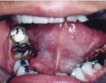 Fig. 3. There were no signs of recurrence at the 2-year follow-up.