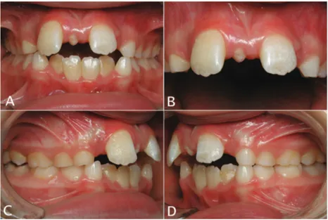 Fig. 1. Pretreatment intraoral photographs: 