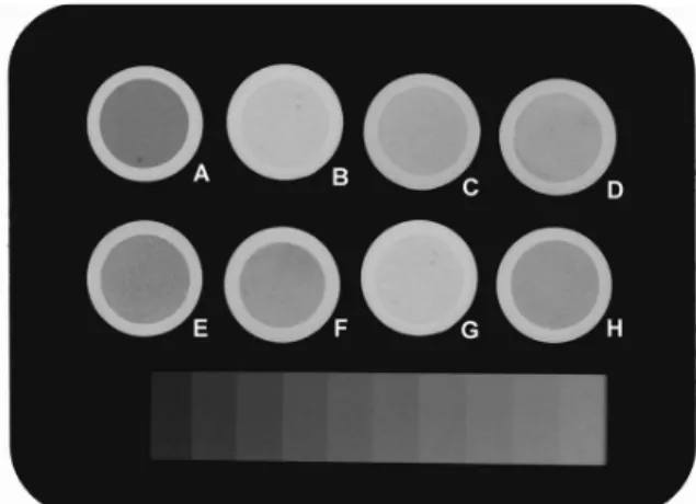Fig. 1. Representative radiography of test samples near the  aluminium stepwedge (bottom): a - Acroseal; b - Endofill;  