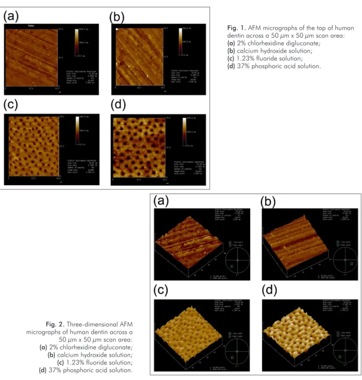 Fig. 2. Three-dimensional AFM   micrographs of human dentin across a  50 µm x 50 µm scan area:  