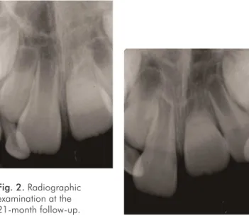 Fig. 2. Radiographic  examination at the  21-month follow-up.