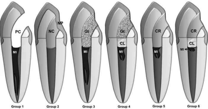 Fig. 1. Schematic illustration of the groups under study. PC: positive control; NC: negative control; NP: nail polish; GI: glass ionomer; 