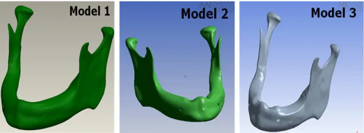 Table  1.  Mechanical  elastic  properties  of  bone  tissue  and  materials used in the  anisotropic  models (16).