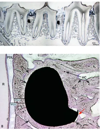 FIGURA 1 - Mandíbula de cão em que Vannet et al. 39 , em 2007, avaliaram his- his-tometricamente a osseointegração de mini-implantes após 6 meses de  anco-ragem esquelética:  A ) a inserção foi entre as raízes dos segundo/terceiro e do  terceiro/quarto pré