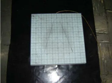 Figure 3. Position of the body during the test. Figure 4. Stabilometric tracing of patient A.M.V with opened eyes.