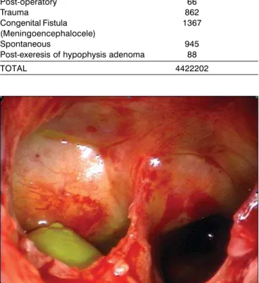 Table 1. Cause of SF leakage site in patients treated by endonasal technique (n=44)